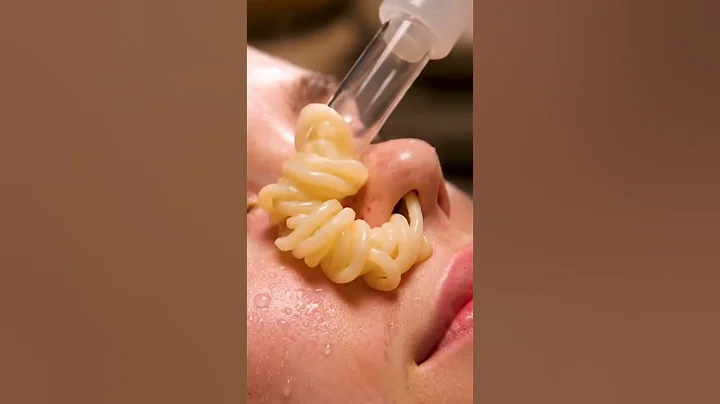 Extreme Vacuum Suction Deep Cleans Nose Pores | ASMR