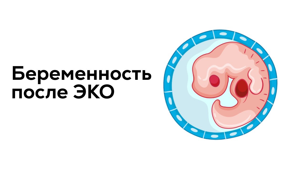 Встать на учет по беременности после эко. Встать на учет по беременности после эко