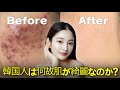 韓国人の肌が綺麗な理由を韓国美容医師が直々に教えます