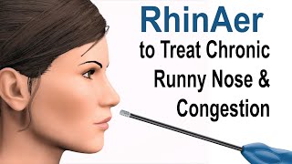 RhinAer to Treat Chronic Runny Nose and Congestion