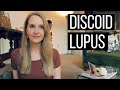 Living With Discoid Lupus