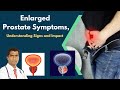 Enlarged prostate symptoms understanding the signs and impact prostate