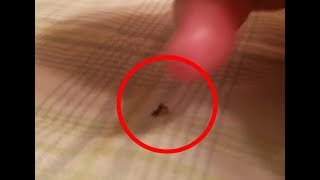 At home bed bug treatment with SayByeBugs