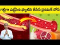 How to Clean Arteries at Home | Avoid Heart Attack | Dr Manthena Satyanarayana Raju Videos