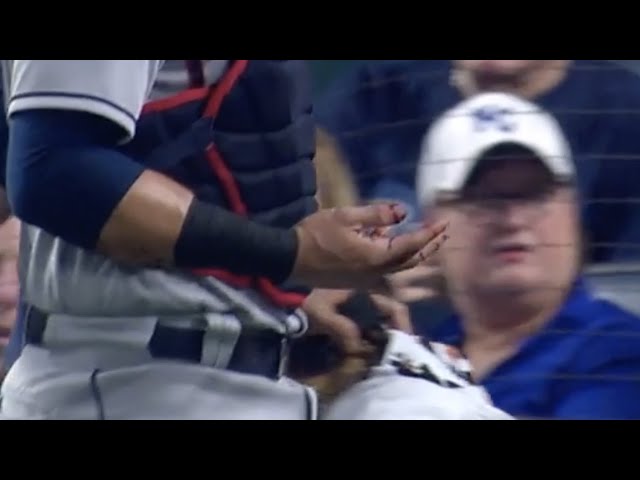 Catcher rips hand open on hitters bat, a breakdown