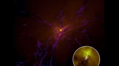 Witnessing Cosmic Dawn