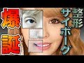 【 1000万円 ⁉︎】 歴代 の 整形箇所 & 整形費用 を 暴露 します