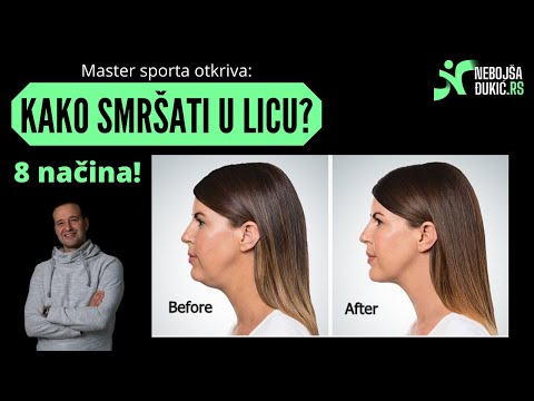 Video: Hemokromatoza: simptomi, liječenje i prognoza