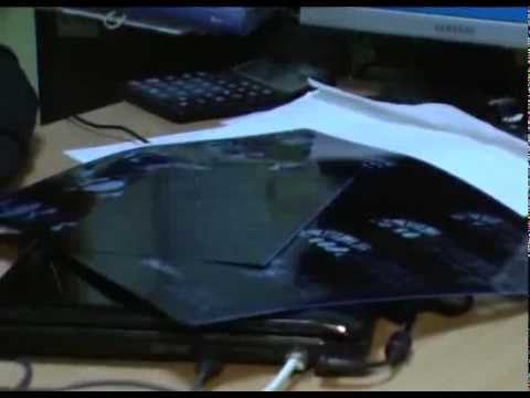 Лечение грыжи позвоночника в клинике Гарвис