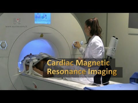 Video: Risonanza Magnetica Cardiaca: Scopo, Procedura E Rischi