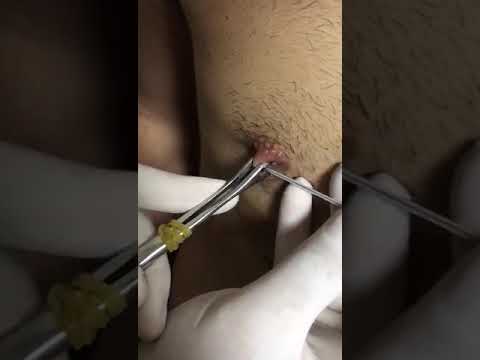Nipple piercing ( meme delimi )