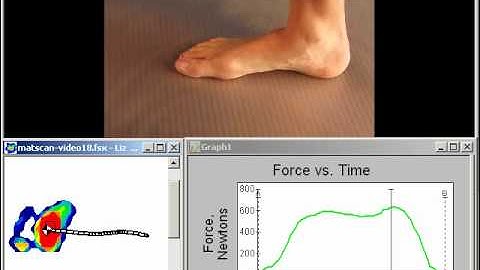 MatScan Barefoot Pressure Measurement and Gait Analysis