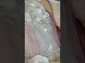 বেস্ট ডেন্টাল ক্লিনিক । কসমেটিক ডেন্টিস্ট