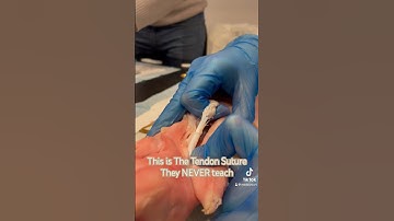 The Silfverskiöld epitendinous repair #tendons #tendonrepair #orthopedics #surgery #flexor #achilles