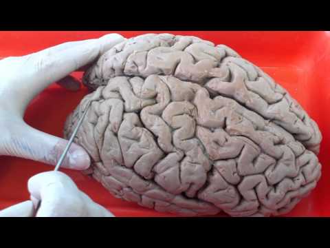 Video: ¿El cerebro tiene circunvoluciones?