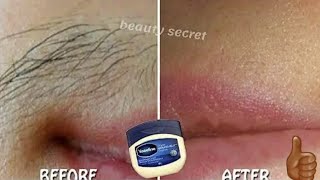 How to use Vaseline to permanently get rid of unwanted hair on your face and body.