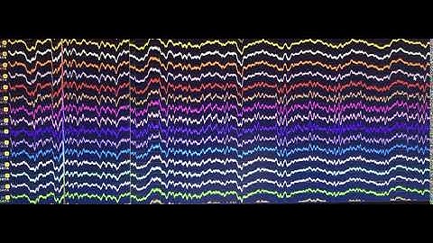 Multielectrode array recording