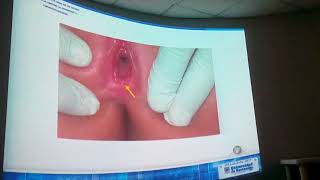 DICTAMEN MÉDICO LEGAL EN LOS DELITOS SEXUALES. Parte 10 (ultima Parte) DICTAMEN MÉDICO LEGAL EN LOS DELITOS SEXUALES. Parte 10 (ultima Parte)