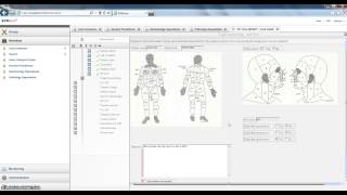 Workflow technology at the dermatology department (test case 1)