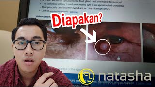 KUPAS TUNTAS HARGA NATASHA SKINCARE +  BIAYA TREATMENT UNTUK MENYEMBUHKAN JERAWAT