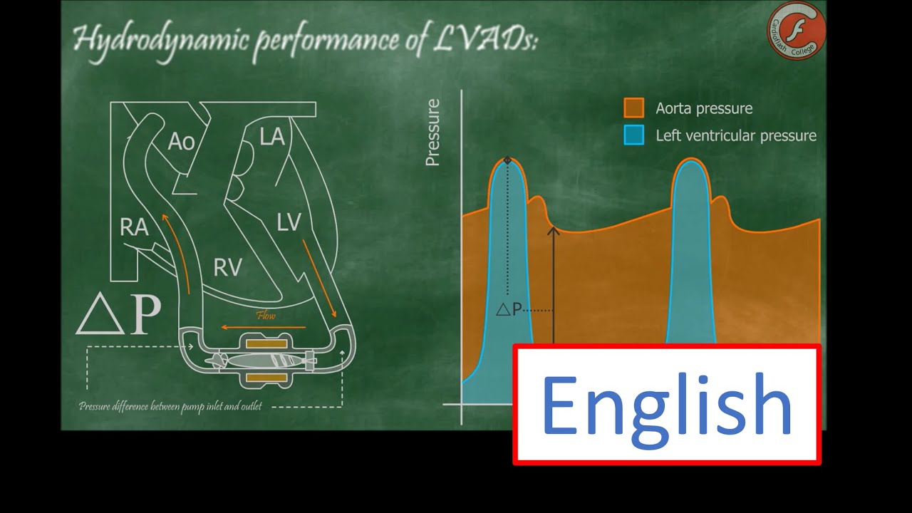 Hydrodynamic performance of LVADs
