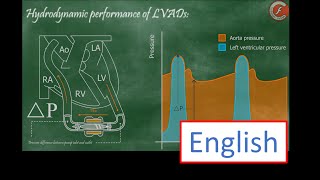 Celebrity Hydrodynamic performance of LVADs Profile