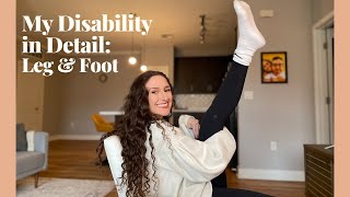 My Leg & Foot | My Disability in Detail | Shaelyn