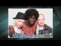 Conheça a história das gêmeas albinas que são filhas de pais negros e sonham em ser modelos