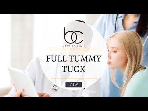 Full Tummy Tuck | Body by Craft Full Tummy Tuck | Body by Craft
