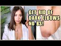 HOW TO GED RID OF DARK ELBOWS | WORKS 100%