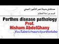 Perthes disease Pathology. Prof. Hisham AbdelGhany. nasrcity online lectures 2020.