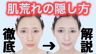 【HowTo】肌荒れが無かったことに!!隠すベースメイク徹底解説!!