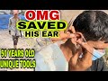 Indian Barber,Street Barber, Much Ear bugs,By 50 Years Old Tools,After Remove Bugs feel Relax(Asmr)
