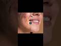 PRO LEVEL FACE RETOUCHING IN Photoshop | ACNE CLEAN IN PHOTOSHOP.