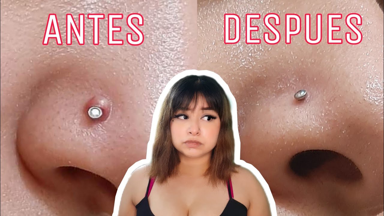 Bolita En El Piercing De La Nariz