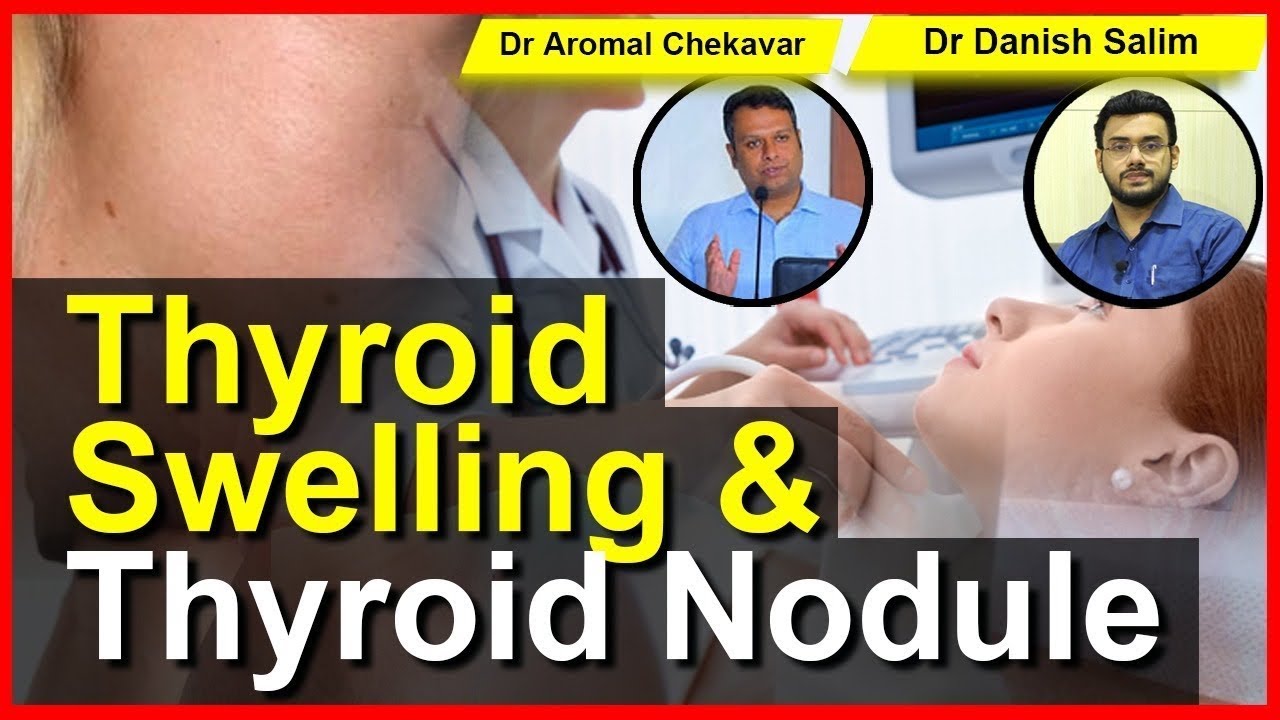 29 Thyroid Swelling Thyroid Nodules When To Worry YouTube 29 thyroid swelling thyroid nodules when to worry youtube
