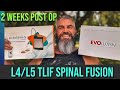 14 days postop update and stitch removal from my 2nd l4l5 tlif spinal fusion  surgery