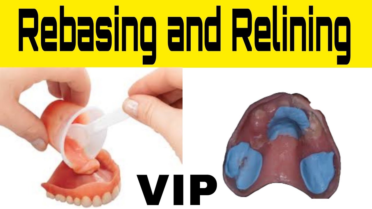 Rebasing and Relining Rebasing and Relining theory Difference