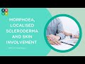 Webinar morphoea localised scleroderma  skin involvement