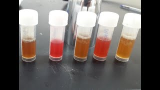 Imvic Test Mr-Vp Test In 5 Minutes شرح مبسط