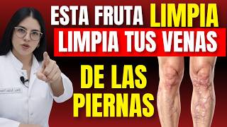 SI QUIERES MEJORAR TU CIRCULACIÓN Y ELIMINAR LAS VENAS VARICES… MIRA ESTO HOY | Dra. GLORIA ARIAS