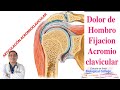 Dolor de Hombro. (Fijación AcromioClavicular)