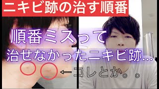 【ニキビ肌の後遺症】色素沈着、クレーター、赤ら顔、毛穴の悩みは治していく順番があります。