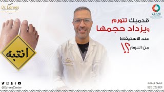 تورم القدمين عند الاستيقاظ من النوم ؟اسبابها و علاجها مجمع د خالد_ادريس الطبي المتخصص