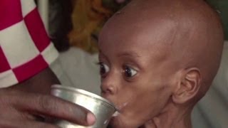 Somalia padece grave hambruna