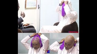 Unveiled - Anas Removes Mask To Reveal Prosthetic