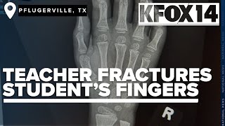 Pflugerville teacher accused of fracturing student's fingers