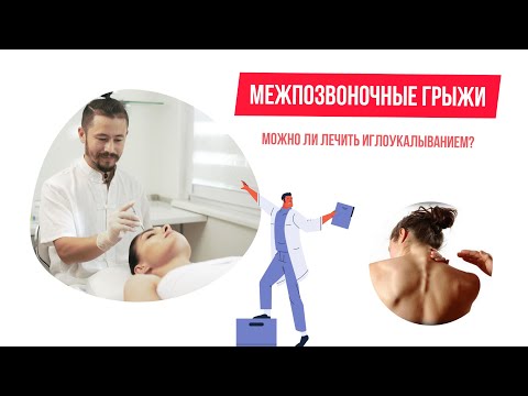 Межпозвоночные грыжи  можно ли лечить иглоукалыванием.