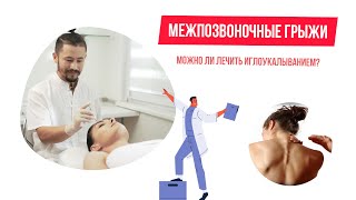 Межпозвоночные грыжи  можно ли лечить иглоукалыванием.