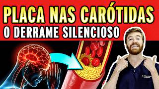Descobri Placa nas Carótidas. E Agora? A Verdade Sobre o Entupimento Silencioso que Pode Causar AVC!